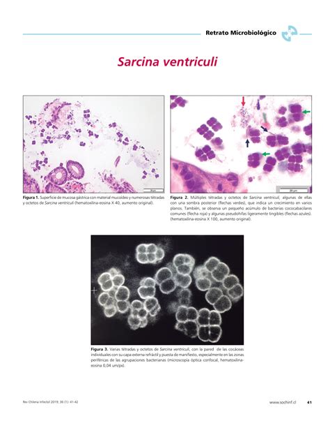 PDF Sarcina Ventriculi