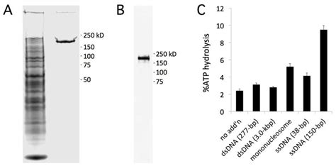 Recombinant Pkl Flag Is A Nucleosome Stimulated Atpase A Extract