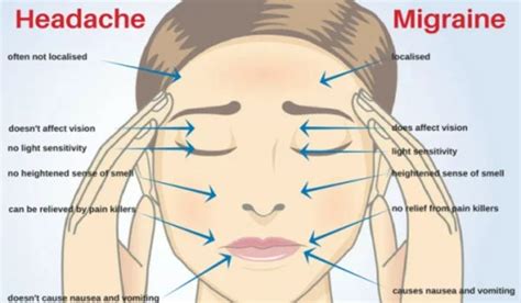 Is Migraine linked to Pregnancy Complications? - Assignment Point