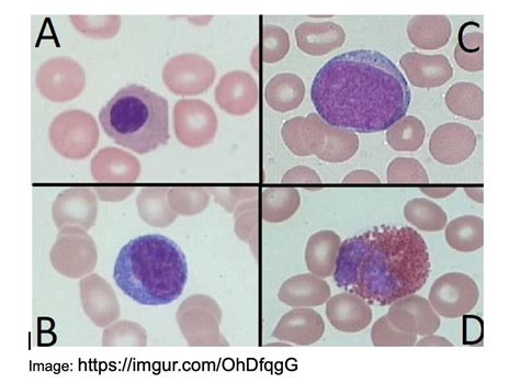 Mount Sinai Department Of Medicine On Twitter 2 Manual Diff Reveals