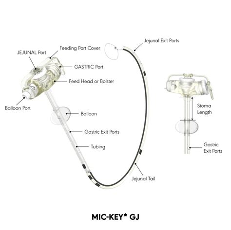 Gastro Jejunal Tube Gj Tube Parts And Extension Tubefed