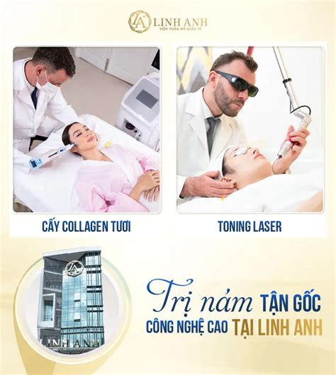 Top 10 spa trị nám Thủ Đức uy tín an toàn tốt nhất 2024