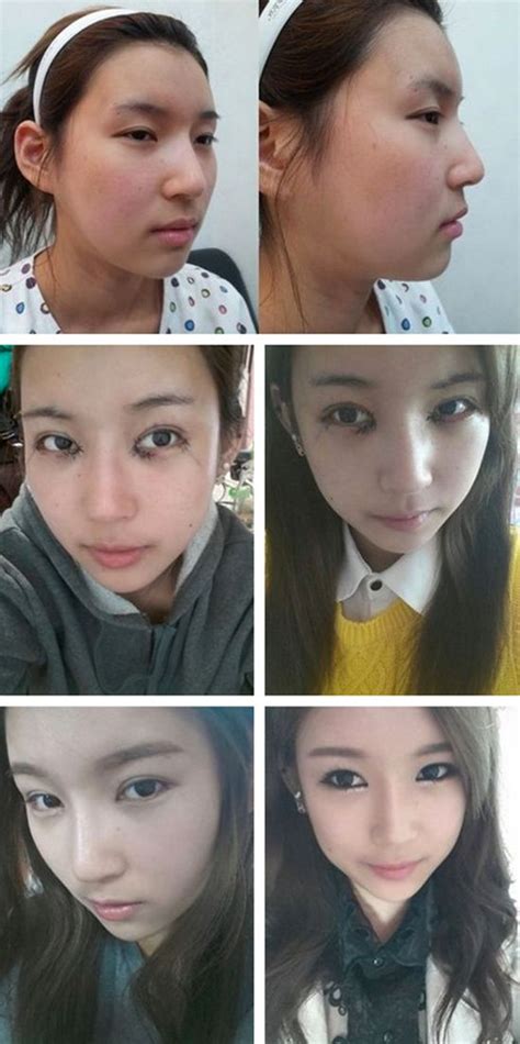 Korean Without Plastic Surgery All Korean