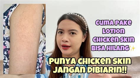 Mengatasi Chicken Skin Keratosis Pilaris Cuma Pake Lotion No Bump