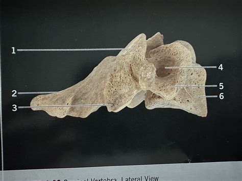 Cervical Vertebrae Lateral View Diagram Quizlet