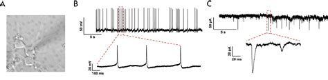 Functional Ipsc Derived Excitatory Neurons Elixirgen Scientific