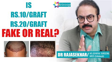 Hair Transplant Per Graft Cost Details Best Hair Transplant Treatment