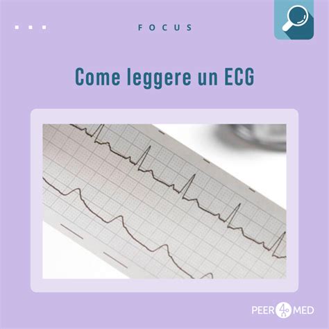 Come Leggere Un Ecg Peer Med