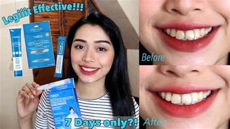 Day Teeth Whitening Ft Perfect Smile Honest Review Maria Selina