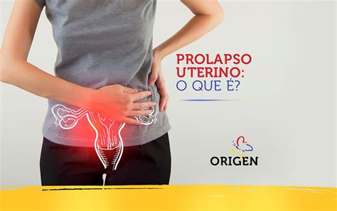 Prolapso Uterino O Que Cl Nica Origen Fertiliza O In Vitro