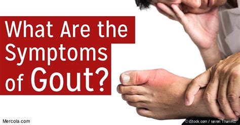 What Are the Symptoms of Gout?