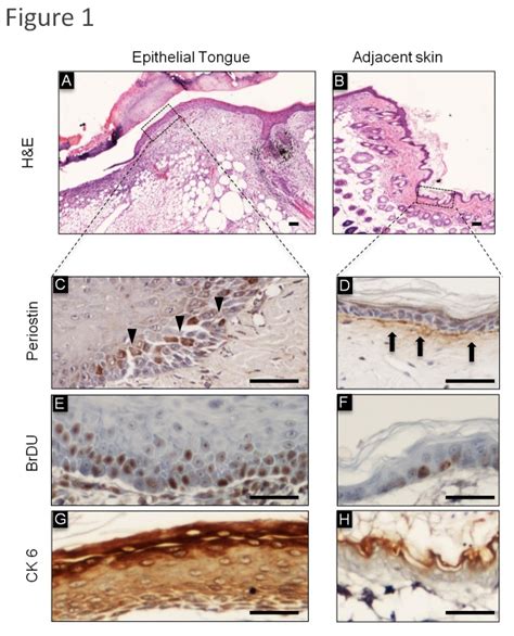 Hande Representative Histological Sections Of Cutaneous Incisional