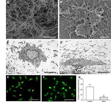 Growth And Survival Of The Cells In Fibrin A And B Scanning Electron Download Scientific