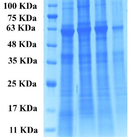 SDS PAGE Patterns Of Different Varieties Of Proteins Abbreviations