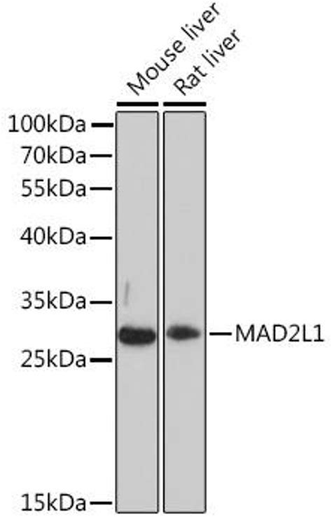 Anti Mad2l1 항체 Cab16911 Assay Genie