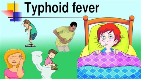 Typhoid Fever - Symptoms And Treatments