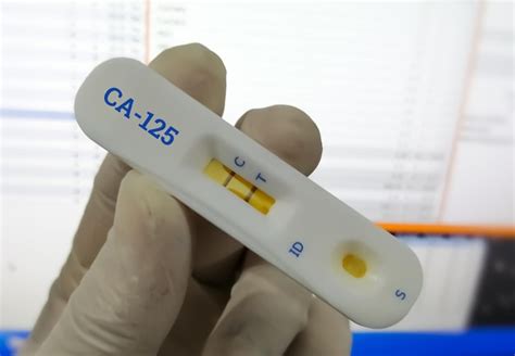 Cassette De Prueba R Pida Para La Prueba De Detecci N R Pida Ca