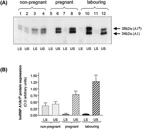 HnRNP A1 A1 B Protein Expression Within The Human Myometrium A