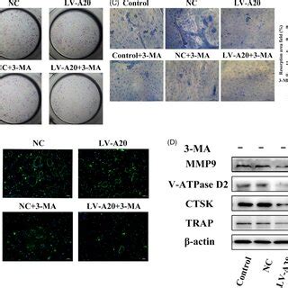 A20 Inhibits Osteoclastogenesis Through Downregulating Autophagy Under