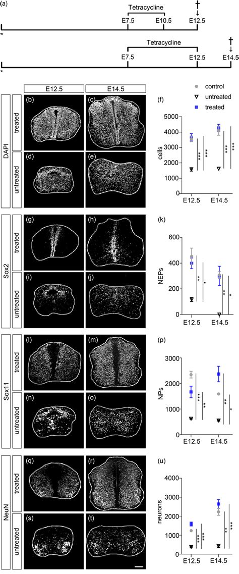 Sox9 overexpression exerts multiple stage‐dependent effects on mouse ... 