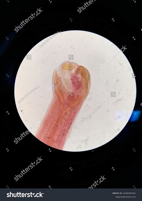 Ancylostoma Duodenale Adult Stage Light Microscope Stock Illustration