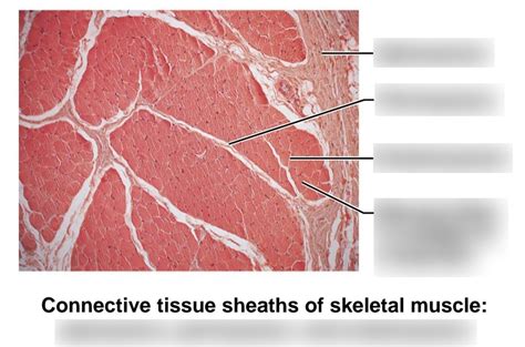 Ch Lab Connective Tissue Sheaths Of Skeletal Muscle Labeling Diagram