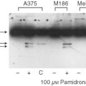 Apoptosis Of Melanoma Cells After Pamidronate Treatment A375 M186