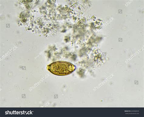 Egg Trichuris Trichiura Whipworm Stool Analyze Nh C S N