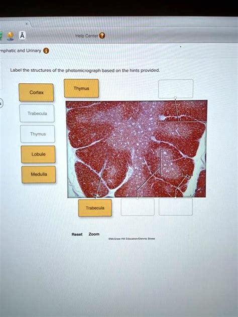 SOLVED Help Center Lymphatic And Urinary Label The Structures Of The