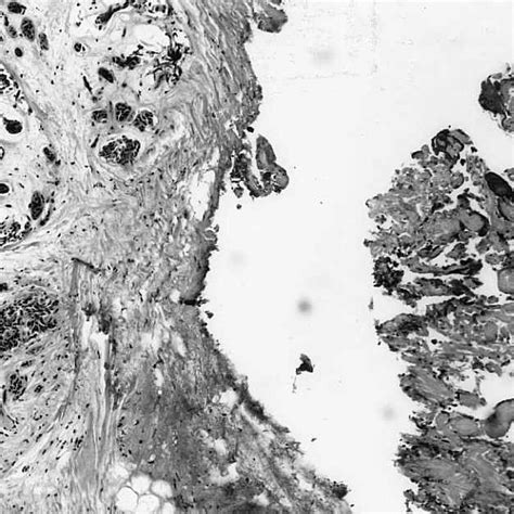 Histology of the pleomorphic adenoma (H & E; 3 4). | Download Scientific Diagram