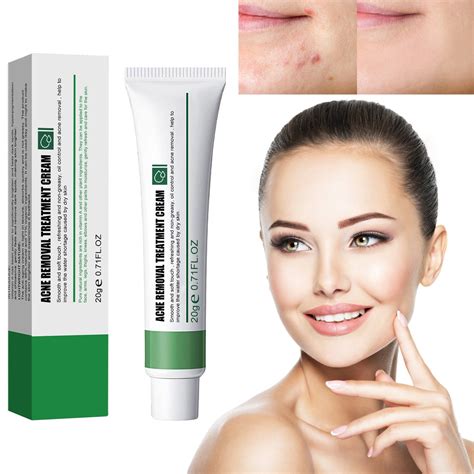 Baycosin Whitening Freckle Acne Scar Removal Anti Wrinkle Moisturizing