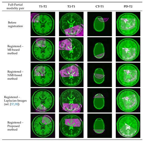 J Imaging Free Full Text Multi Modal Medical Image Registration