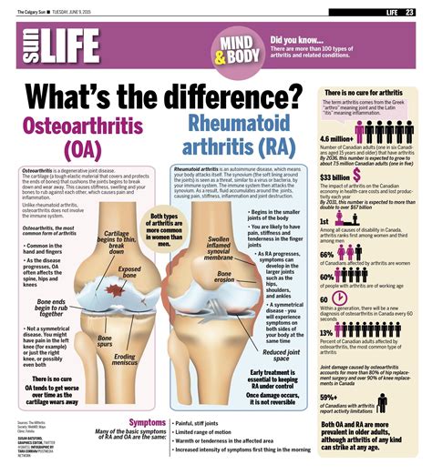 Rheumatoid arthritis symptoms risk factors treatment – Artofit