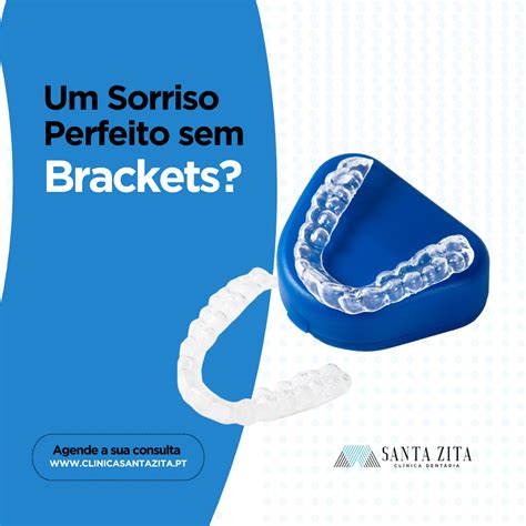 Aparelhos Ortodônticos Invisíveis Invisalign Um Sorriso Perfeito sem