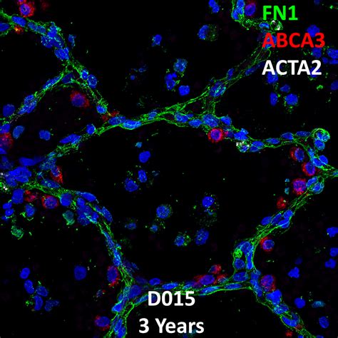 3 Year Old Human Lung Immunofluorescence And Confocal Imaging Donor