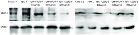 Western Blotting Analysis Of Mmp 2 Protein Expression In The Sclera Of Download Scientific