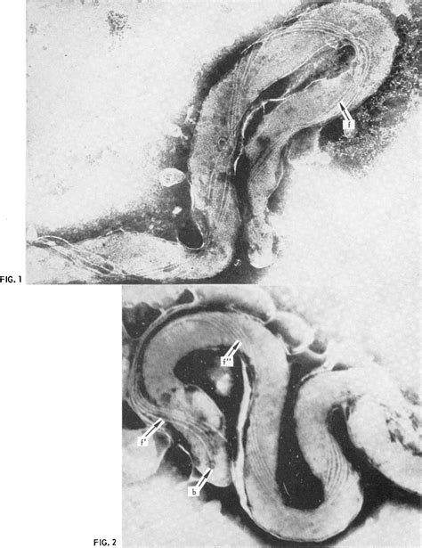 Figure I From J Morphology Of Treponema Pallidum Semantic Scholar