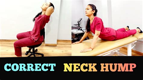 Neck Hump Exercises In Hindi Correct Neck Hump At Home Dowagers Hump