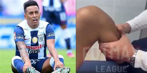 VIDEO Estaba roto así estaba la rodilla de Christian Cueva en