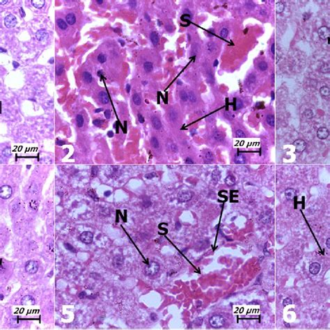 Representative Light Micrographs Of The Liver Sections Subjected To