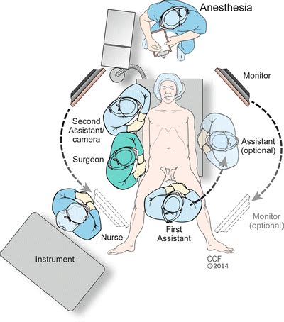 ileostomy Reversal Surgery | Surgical Associates Of Houston