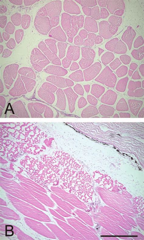 Representative Photomicrographs Of Sections Of Cheek Tissue At The Site