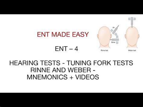 Hearing Tests Rinne And Weber Ent Tuning Fork Mnemonic