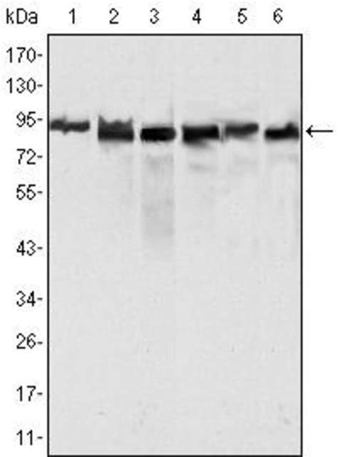 MLH1 Monoclonal Antibody (4C9C7), Invitrogen 100 μL; Unconjugated ...