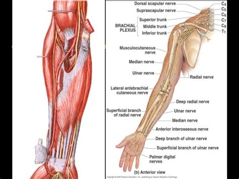 Radial nerve injury