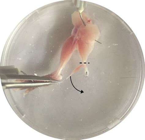 Dissection Of Mouse EDL And Soleus Muscles