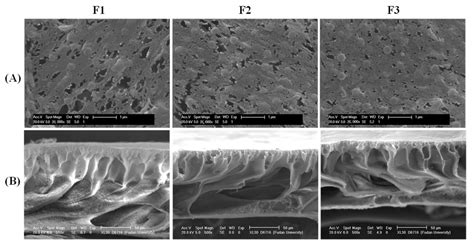 Membranes Free Full Text Preparation Of Nano Tio Modified Pvdf