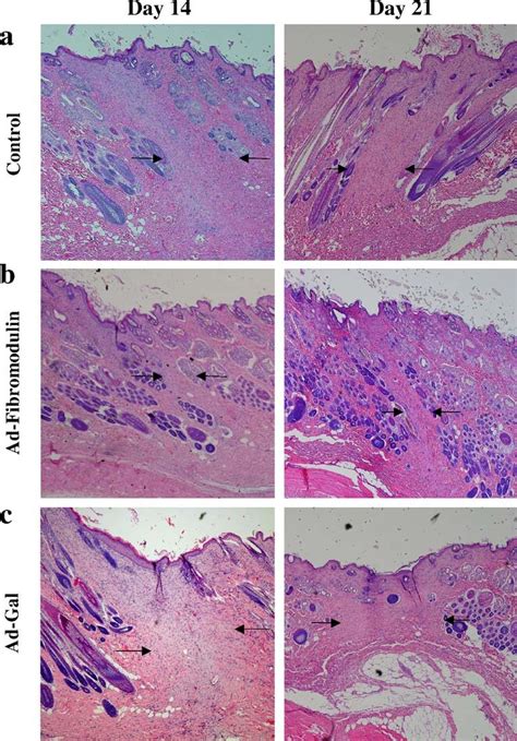 Histopathological Examination Of Full Thickness Incisional Wounds At