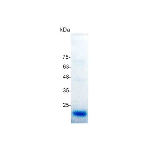 Vegf Human Atlantis Bioscience Pte Ltd