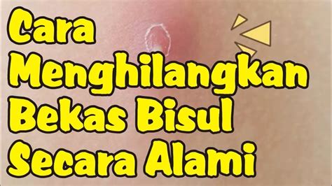 Cara Menghilangkan Bekas Bisul Secara Alami Youtube